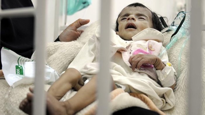 Yemen'de 100 bin çocuğun hayatı tehlikede