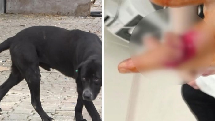 Sokak köpekleri yine saldırdı! Genç kadın kendini zor kurtardı 
