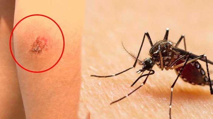 Uzmanlardan ‘Asya Kaplan Sivrisineği’ uyarısı!