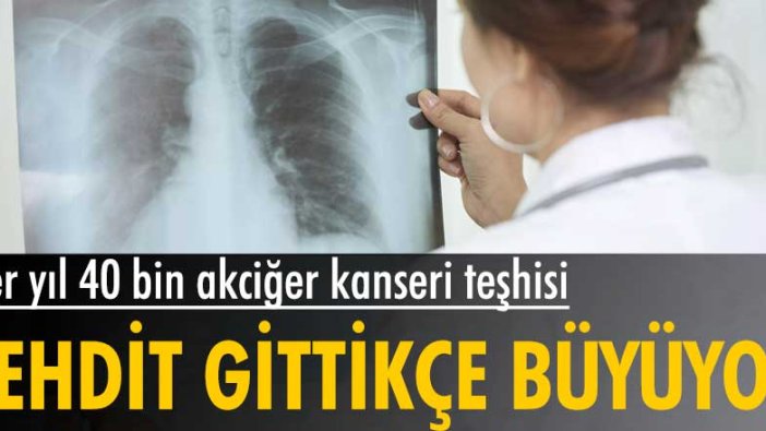 Türkiye'de her yıl 40 bin kişiye akciğer kanseri teşhisi... Tehdit gittikçe büyüyor
