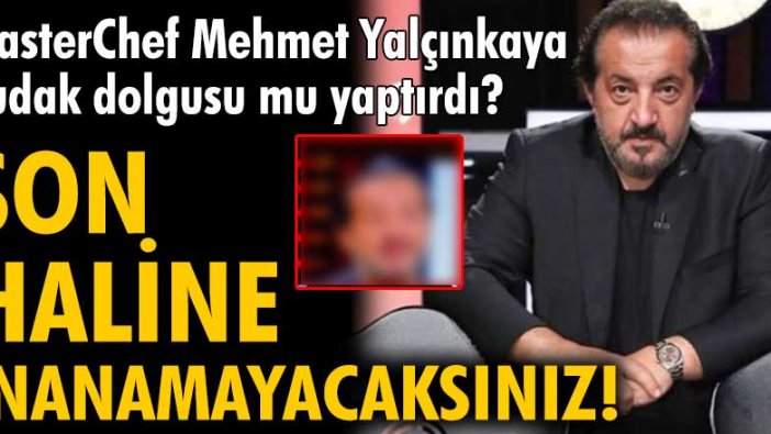 MasterChef jürisi Mehmet Yalçınkaya dudak dolgusu mu yaptırdı?